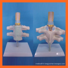 Vivid Human Cervical Vertebra, Spinal Nerve Anatomical Model